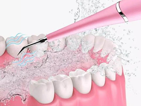 Skaler dentystyczny ultradźwiękowy do kamienia Skaler dentystyczny ultradźwiękowy do kamienia