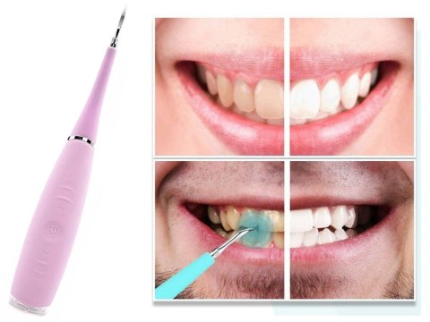 Skaler dentystyczny ultradźwiękowy do kamienia Skaler dentystyczny ultradźwiękowy do kamienia