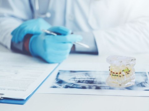Model stomatologiczny szczęka zęby zębów aparat ortodontyczny Model stomatologiczny szczęka zęby zębów aparat ortodontyczny