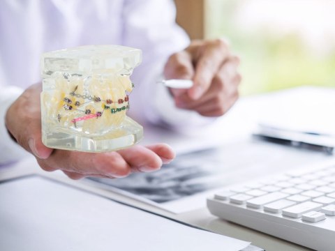Model stomatologiczny szczęka zęby zębów aparat ortodontyczny Model stomatologiczny szczęka zęby zębów aparat ortodontyczny