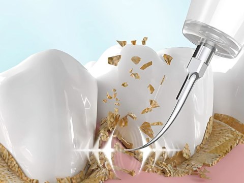 Skaler dentystyczny ultradźwiękowy do czyszczenia zębów usuwanie kamienia Skaler dentystyczny ultradźwiękowy do czyszczenia zębów usuwanie kamienia
