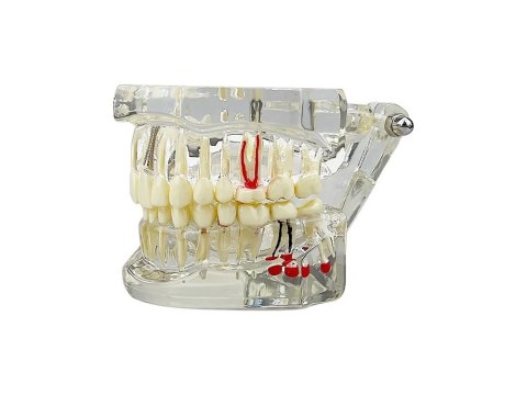 Model stomatologiczny szczęka zęby zębow implanty Model stomatologiczny szczęka zęby zębow implanty