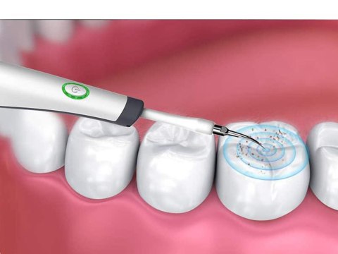 Skaler dentystyczny ultradźwiękowy do czyszczenia zębów usuwanie kamienia Skaler dentystyczny ultradźwiękowy do czyszczenia zębów usuwanie kamienia